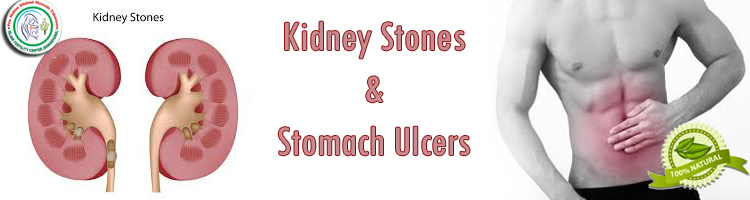 kidney-stones-stomach-ulcers-islamic-fertility-center